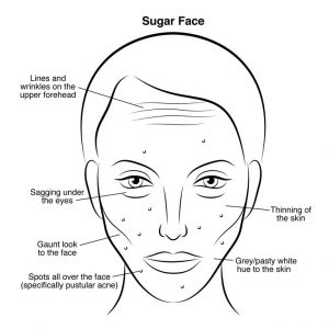sugar face  300x300 - セレブを顧客に持つ皮膚科専門医が明かす美肌の秘訣とは